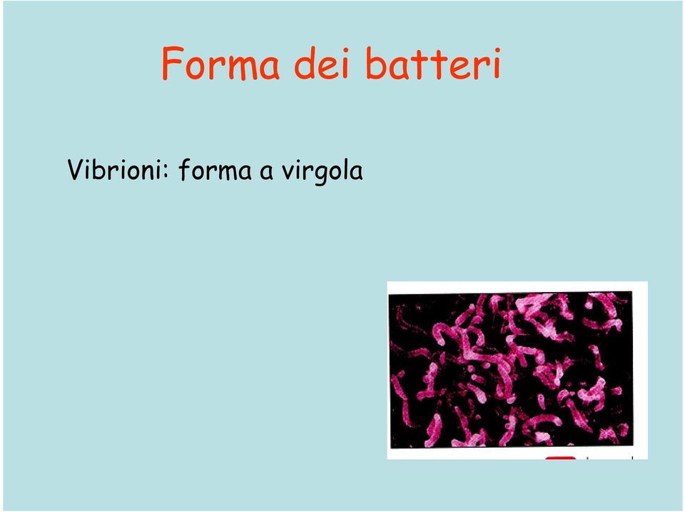 Vibrioni: