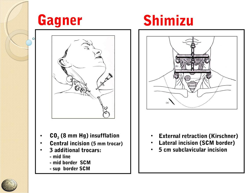 - sup border SCM Shimizu External retraction (Kirschner)