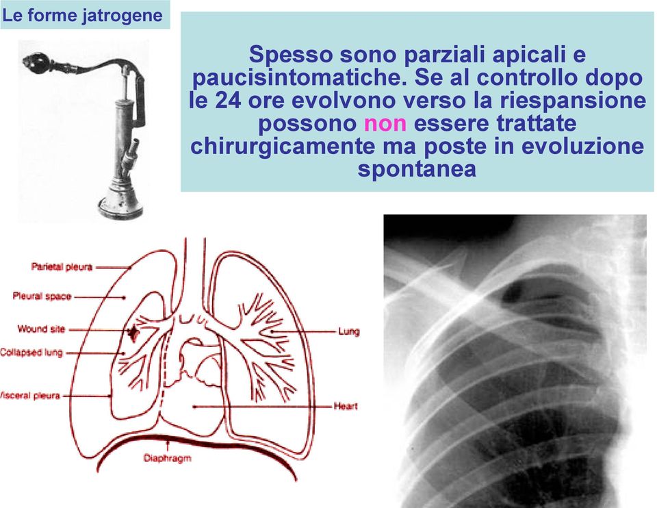 Se al controllo dopo le 24 ore evolvono verso la