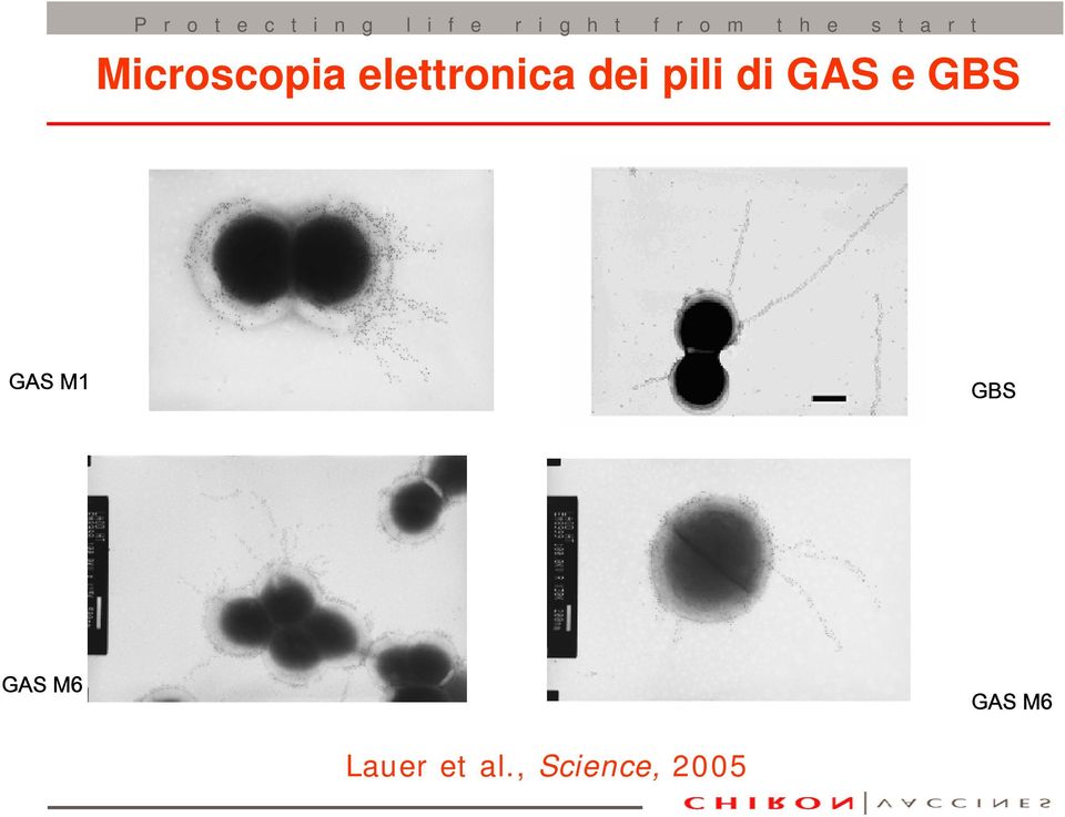 GAS M1 GBS GAS M6 GAS M6