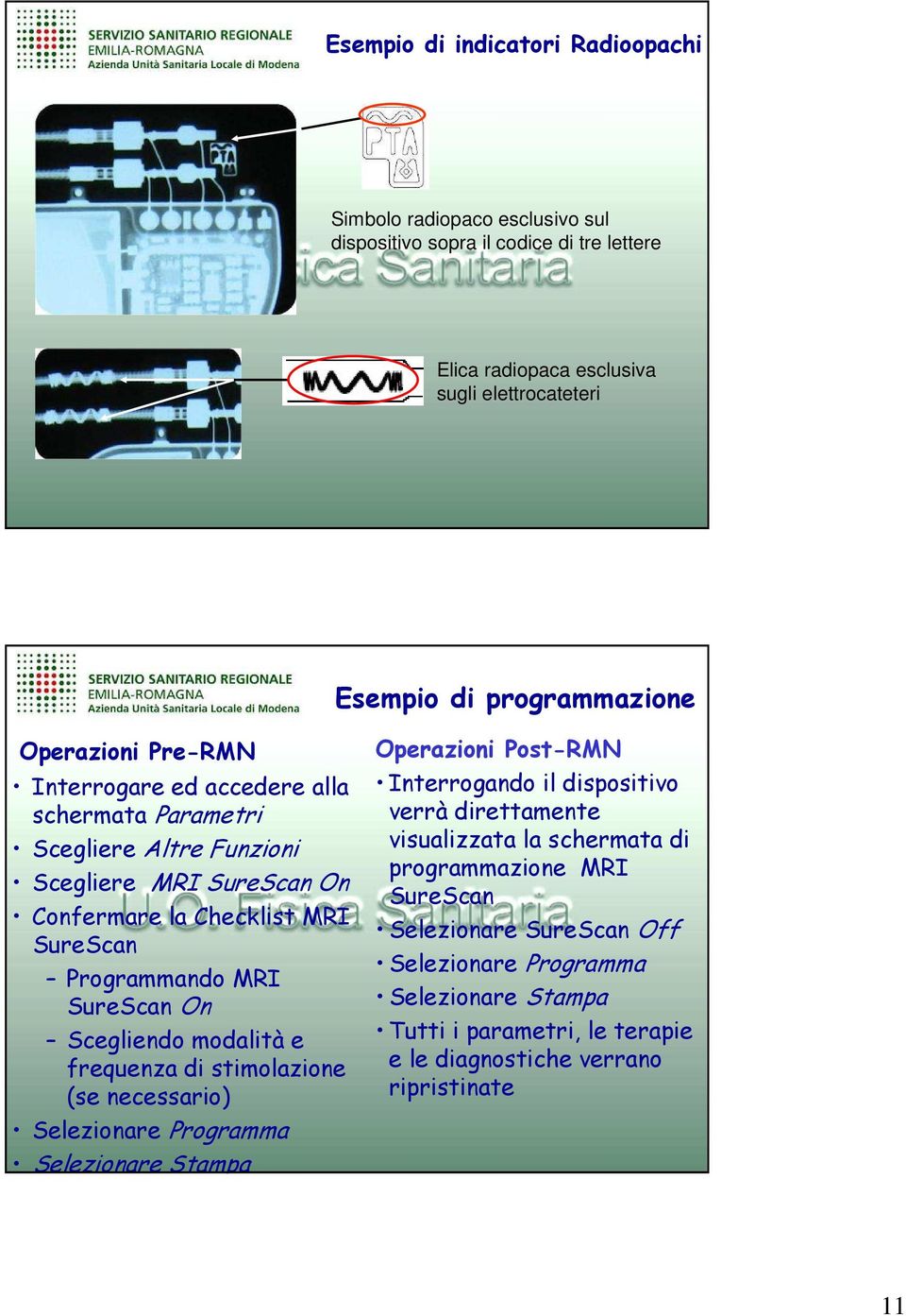 On Scegliendo modalità e frequenza di stimolazione (se necessario) Selezionare Programma Selezionare Stampa Operazioni Post-RMN Interrogando il dispositivo verrà direttamente