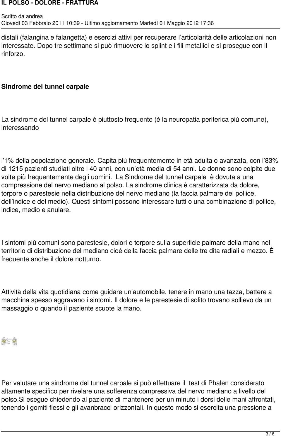 Sindrome del tunnel carpale La sindrome del tunnel carpale è piuttosto frequente (è la neuropatia periferica più comune), interessando l 1% della popolazione generale.