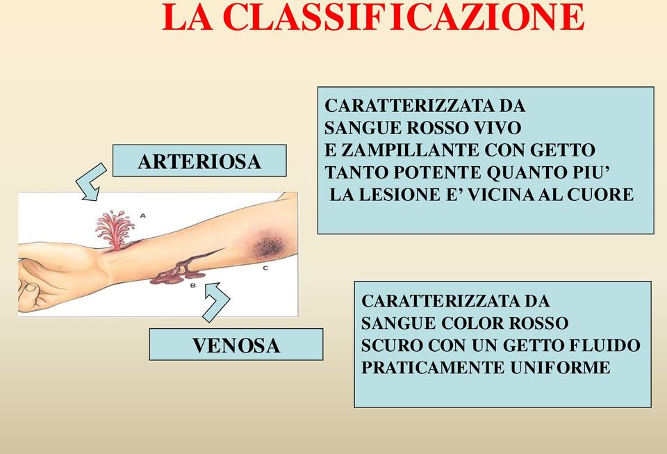 PIU LA LESIONE E VICINA AL CUORE VENOSA CARATTERIZZATA DA