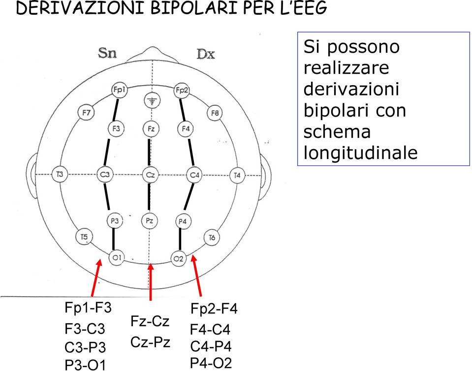 con schema longitudinale Fp1-F3 F3-C3