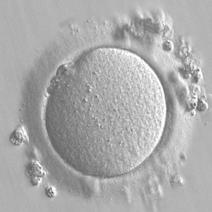 CRIOCONSERVAZIONE DELLA FERTILITÀ Istituto Internazionale di Medicina della Riproduzione International Institute for