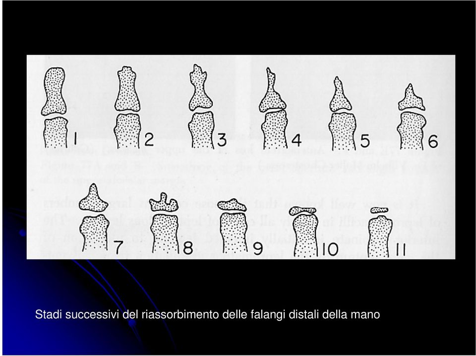 riassorbimento