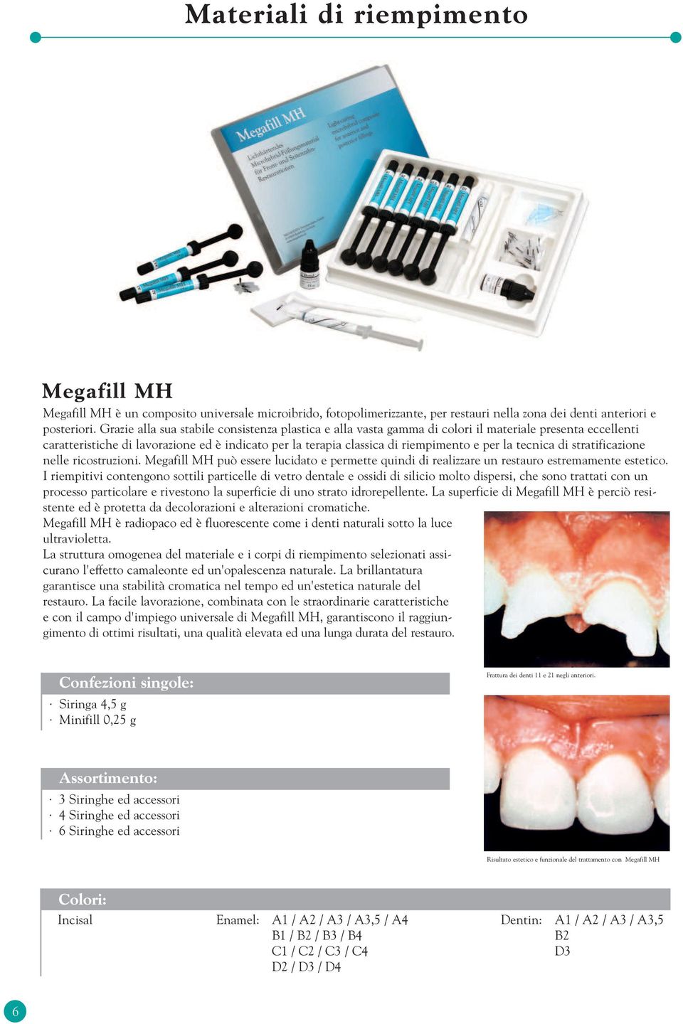 tecnica di stratificazione nelle ricostruzioni. Megafill MH può essere lucidato e permette quindi di realizzare un restauro estremamente estetico.