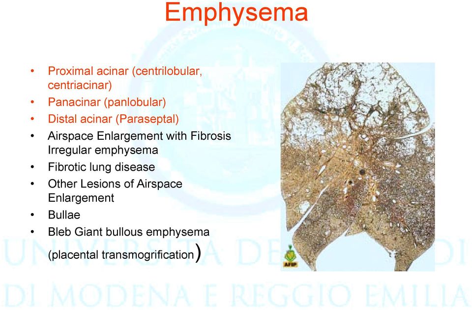 Fibrosis Irregular emphysema Fibrotic lung disease Other Lesions of