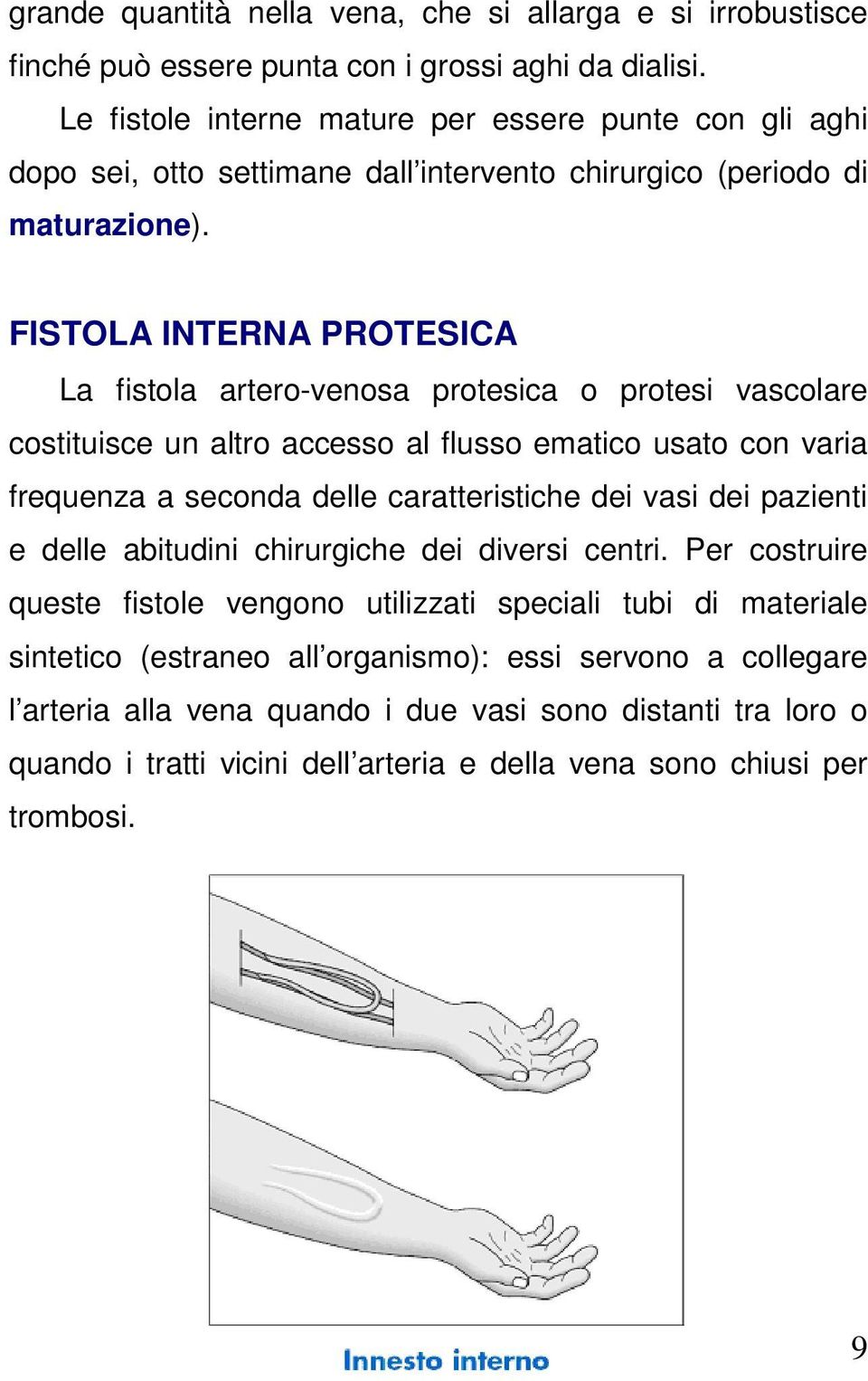 FISTOLA INTERNA PROTESICA La fistola artero-venosa protesica o protesi vascolare costituisce un altro accesso al flusso ematico usato con varia frequenza a seconda delle caratteristiche dei vasi