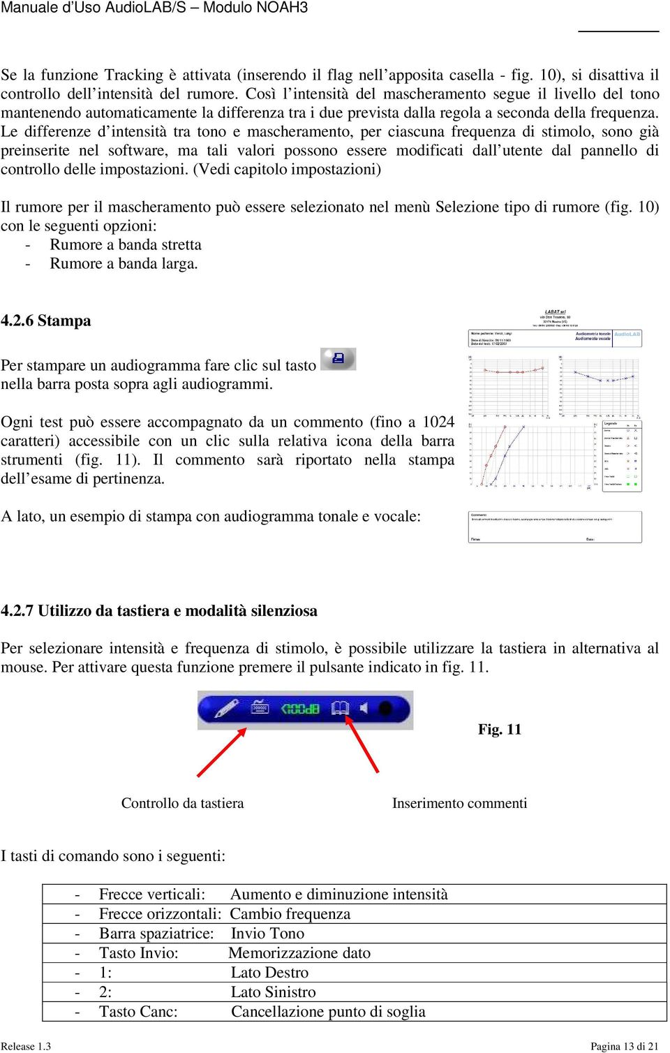 Le differenze d intensità tra tono e mascheramento, per ciascuna frequenza di stimolo, sono già preinserite nel software, ma tali valori possono essere modificati dall utente dal pannello di