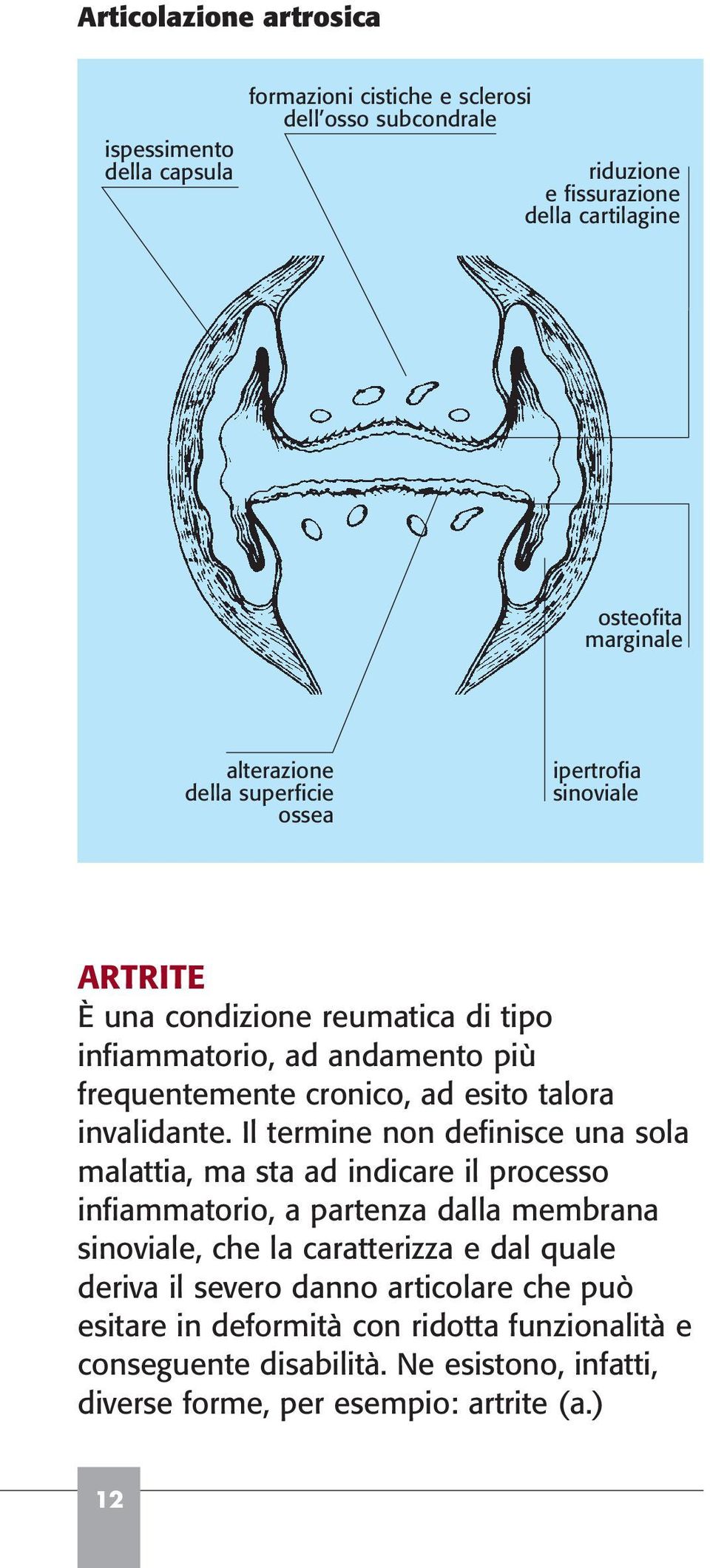 invalidante.