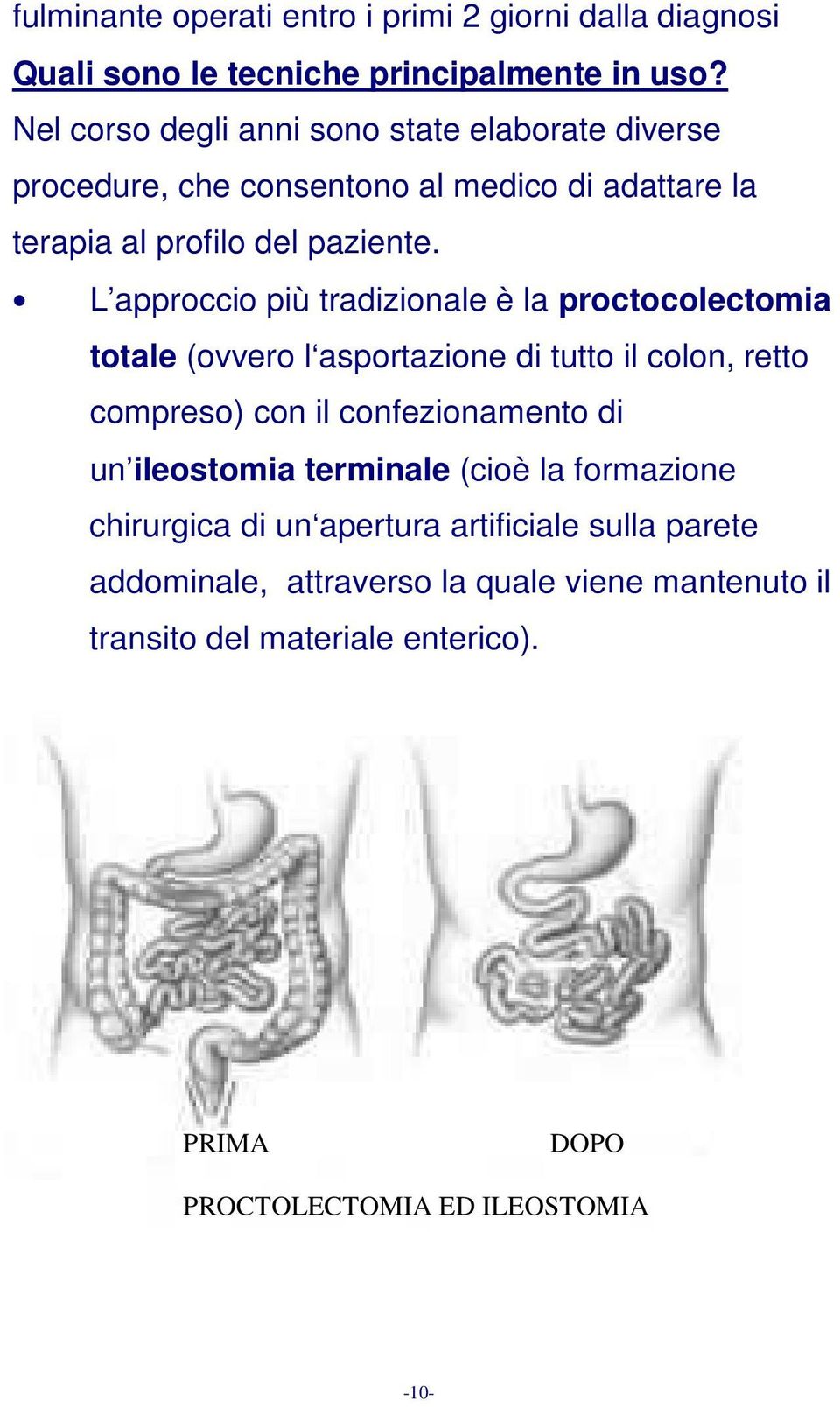 L approccio più tradizionale è la proctocolectomia totale (ovvero l asportazione di tutto il colon, retto compreso) con il confezionamento di un