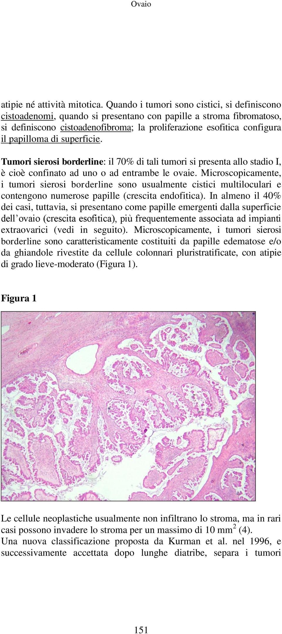di superficie. Tumori sierosi borderline: il 70% di tali tumori si presenta allo stadio I, è cioè confinato ad uno o ad entrambe le ovaie.