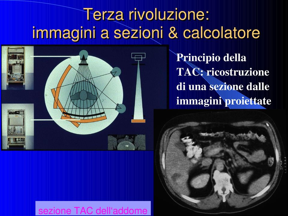 ricostruzione di una sezione dalle