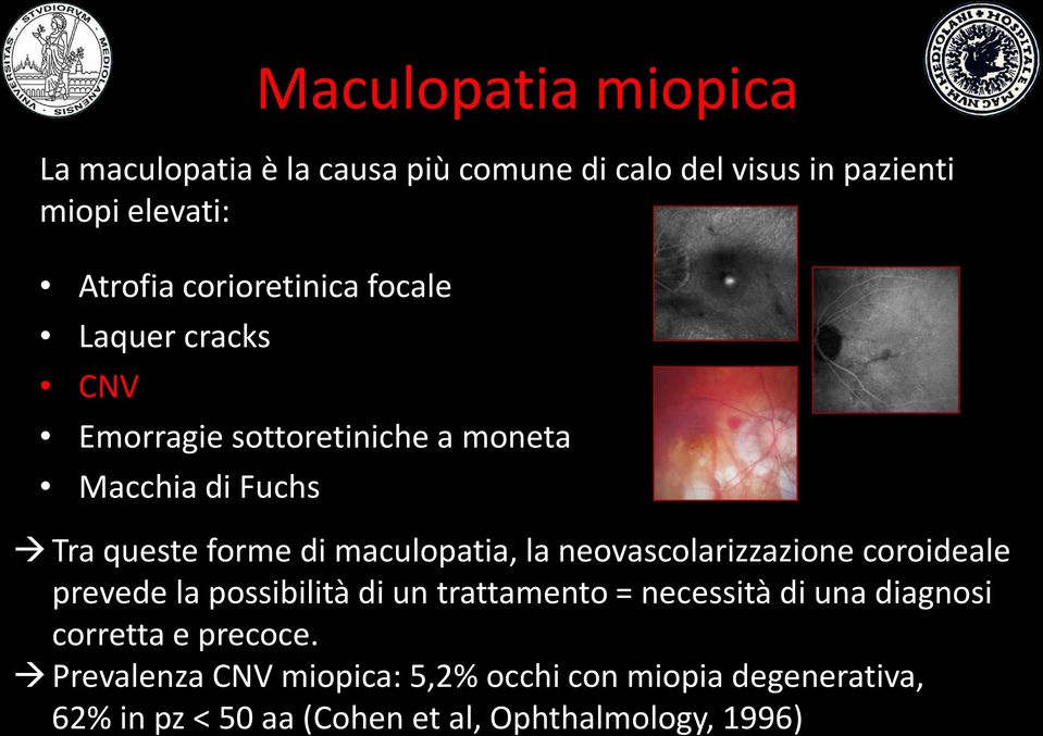 maculopatia, la neovascolarizzazione coroideale prevede la possibilità di un trattamento = necessità di una diagnosi