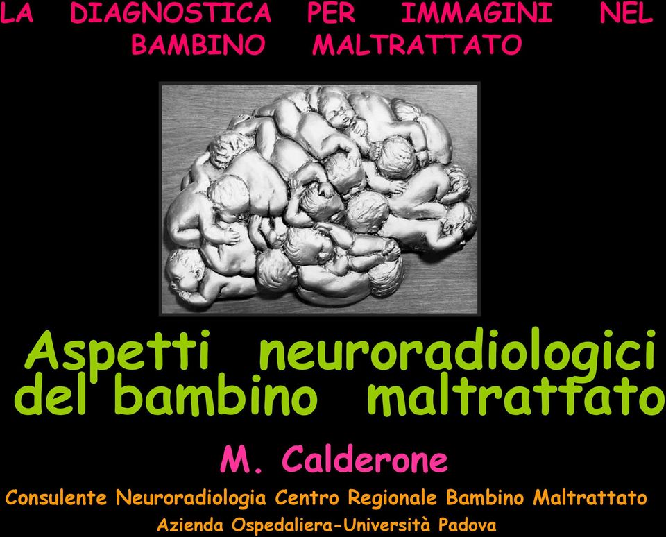 Calderone Consulente Neuroradiologia Centro Regionale