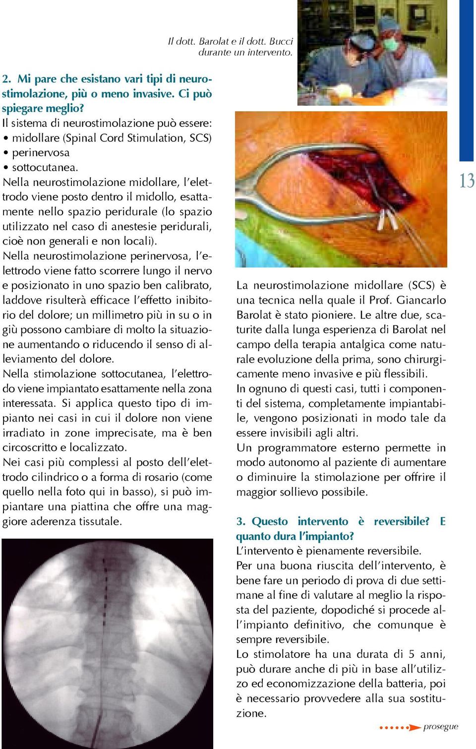 Nella neurostimolazione midollare, l elettrodo viene posto dentro il midollo, esattamente nello spazio peridurale (lo spazio utilizzato nel caso di anestesie peridurali, cioè non generali e non