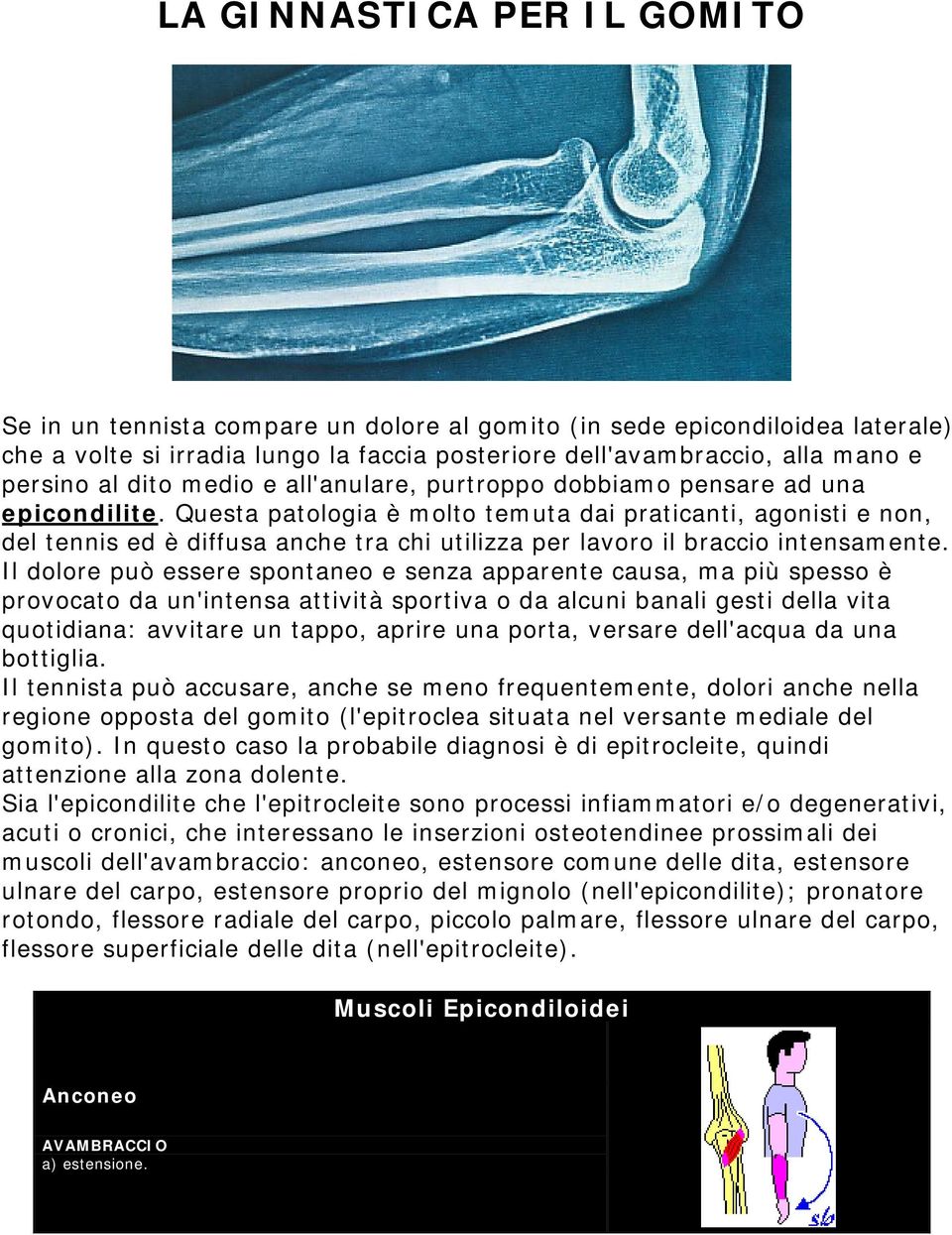 Questa patologia è molto temuta dai praticanti, agonisti e non, del tennis ed è diffusa anche tra chi utilizza per lavoro il braccio intensamente.