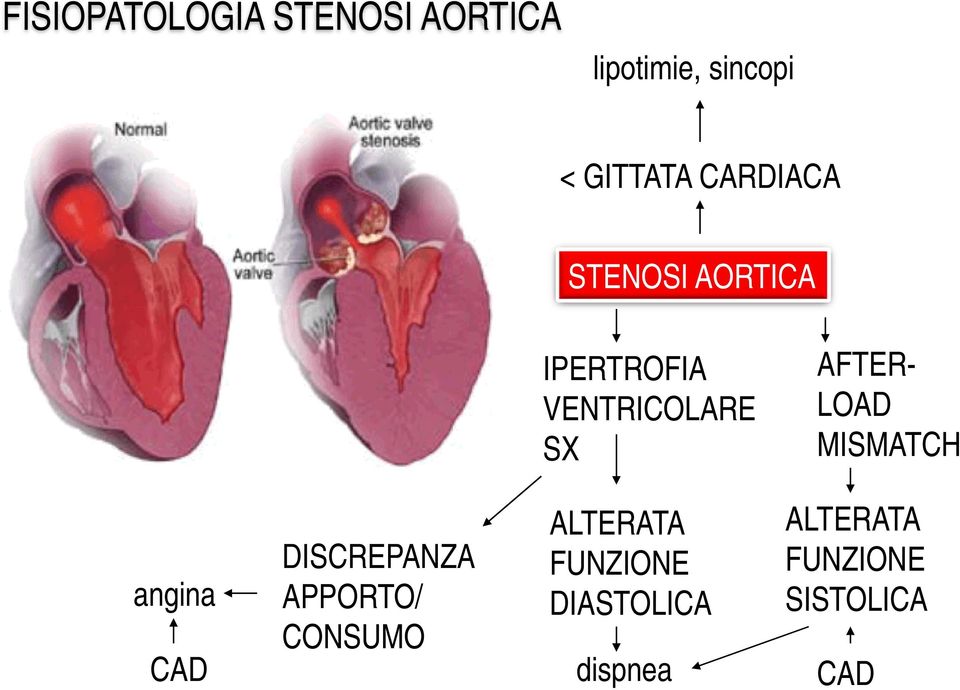 LOAD MISMATCH angina CAD DISCREPANZA APPORTO/ CONSUMO