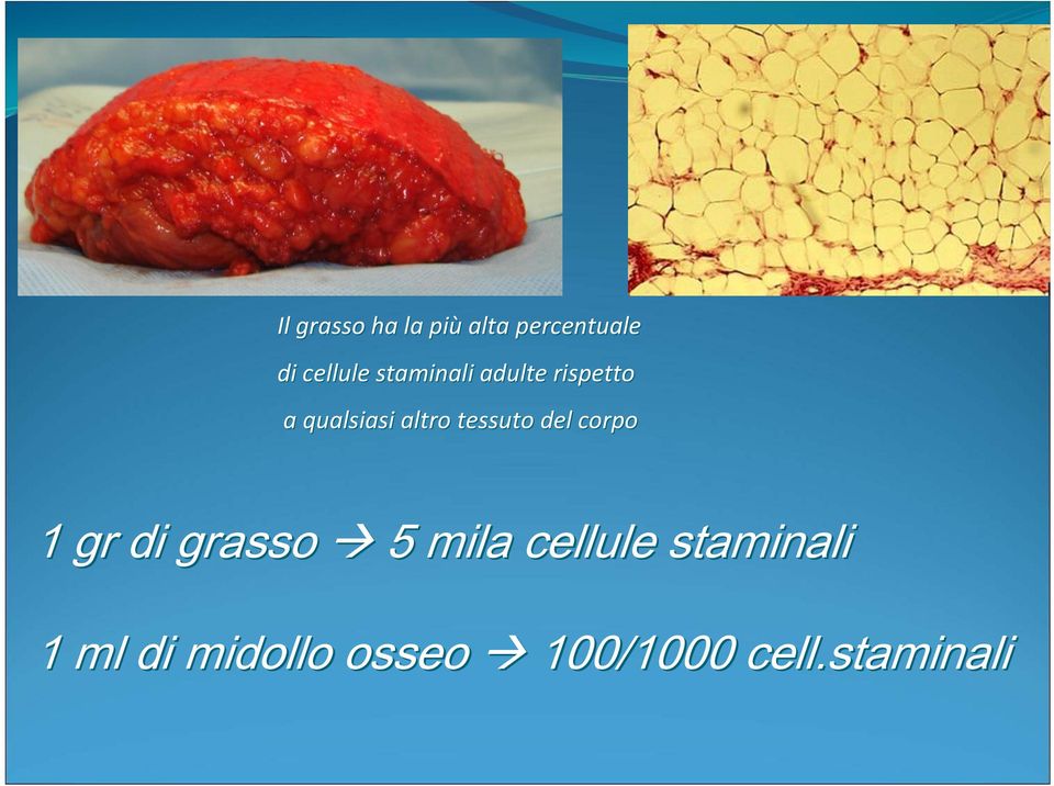 tessuto del corpo 1 gr di grasso 5 mila cellule