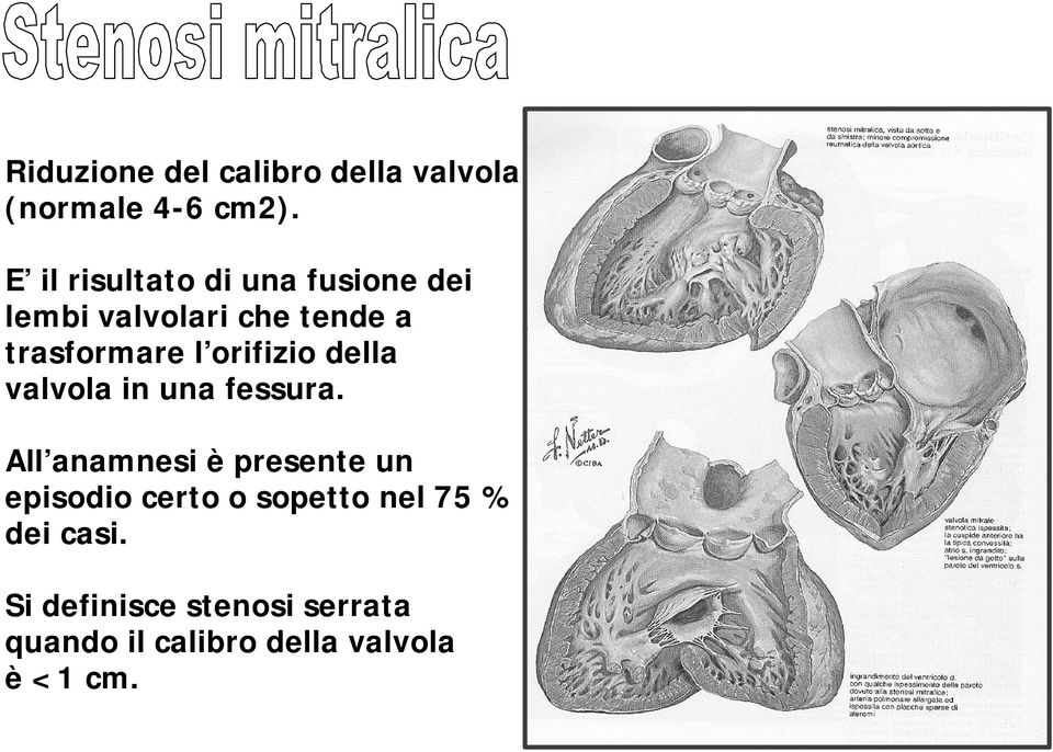 orifizio della valvola in una fessura.