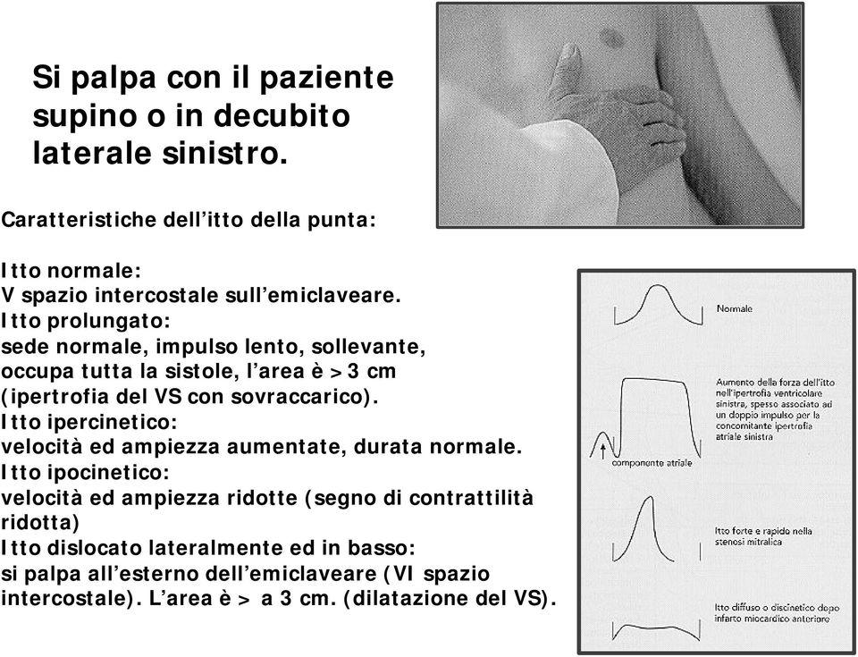 Itto prolungato: sede normale, impulso lento, sollevante, occupa tutta la sistole, l area è >3 cm (ipertrofia del VS con sovraccarico).