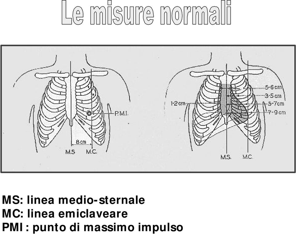 linea emiclaveare