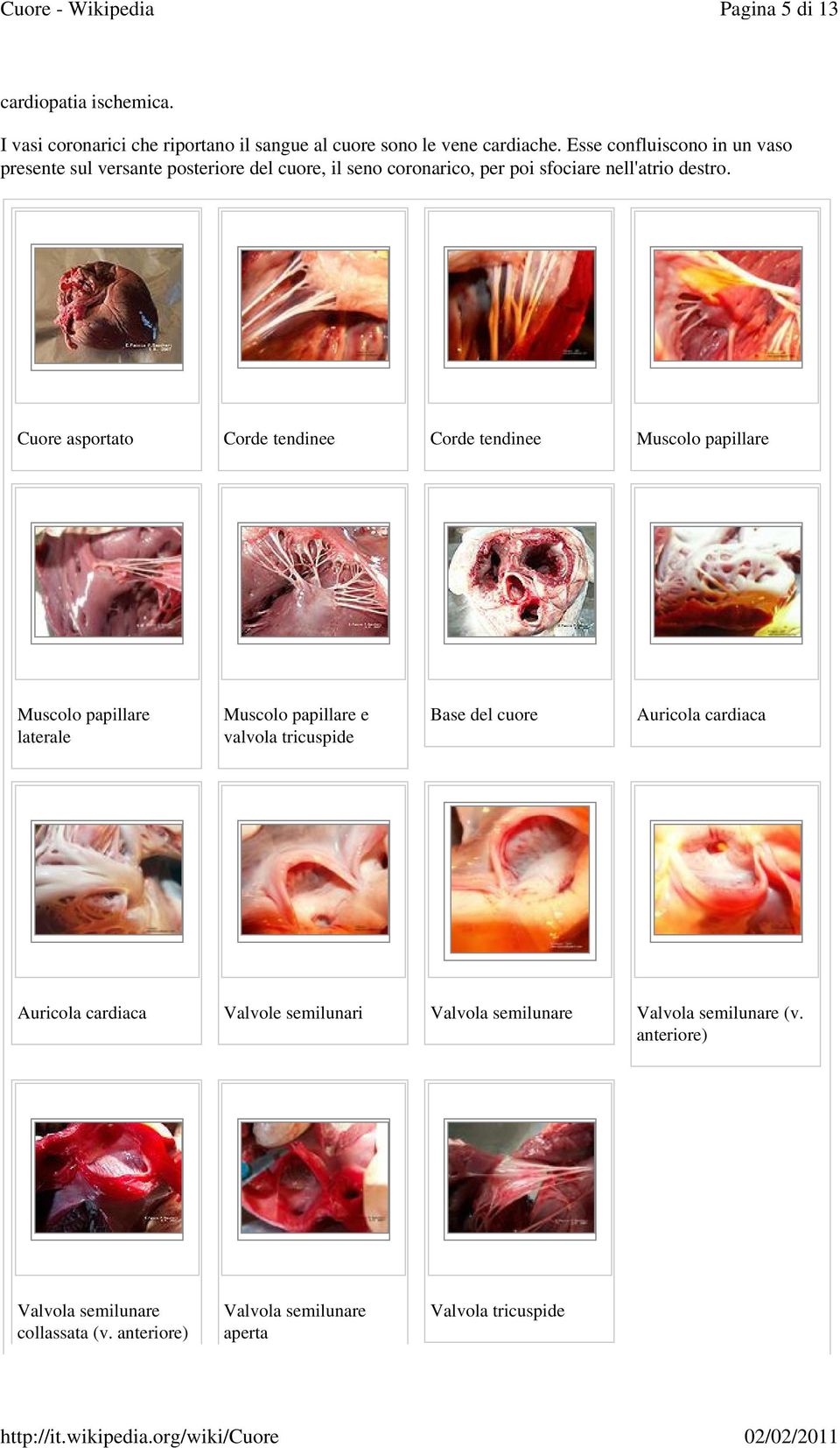 Cuore asportato Corde tendinee Corde tendinee Muscolo papillare Muscolo papillare laterale Muscolo papillare e valvola tricuspide Base del cuore