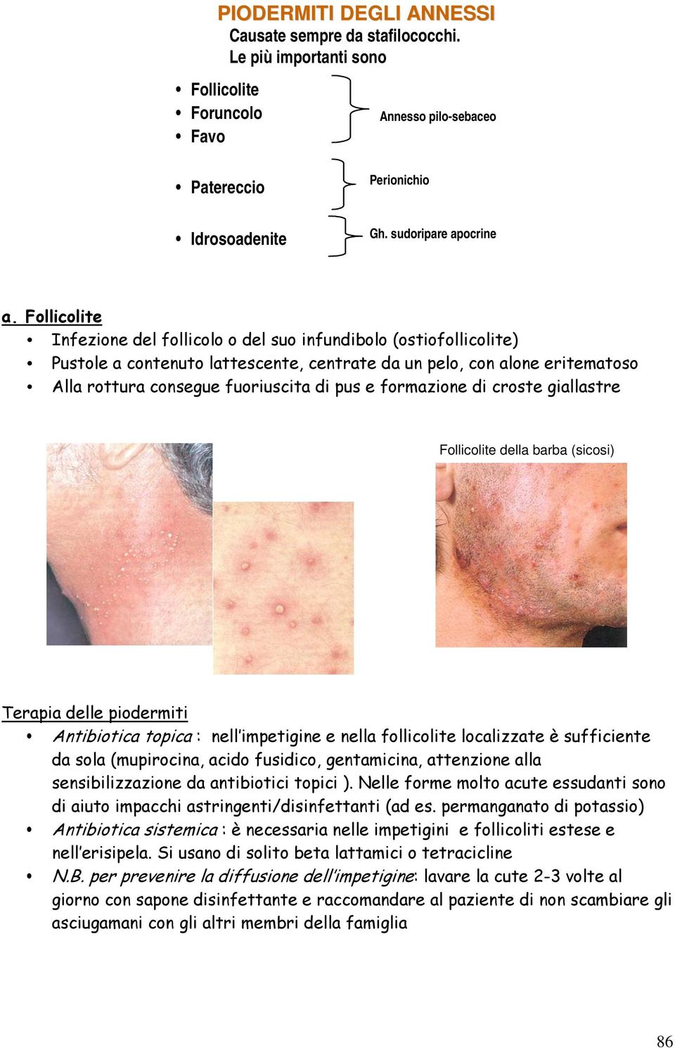 formazione di croste giallastre Follicolite della barba (sicosi) Terapia delle piodermiti Antibiotica topica : nell impetigine e nella follicolite localizzate è sufficiente da sola (mupirocina, acido