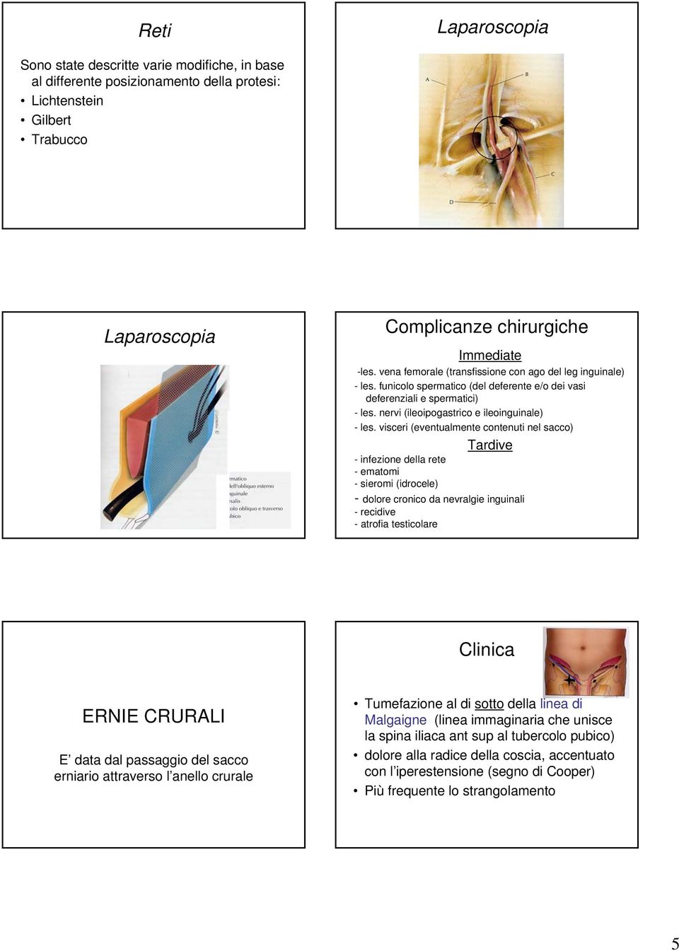 visceri (eventualmente contenuti nel sacco) Tardive - infezione della rete - ematomi - sieromi (idrocele) - dolore cronico da nevralgie inguinali - recidive - atrofia testicolare Clinica ERNIE