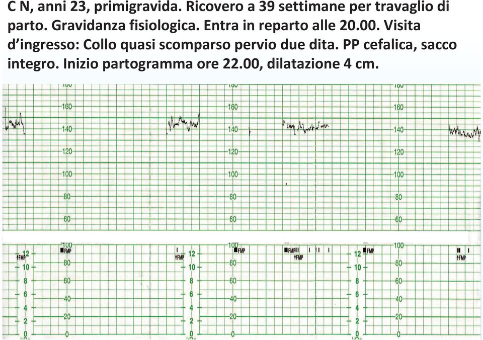 Gravidanza fisiologica. Entra in reparto alle 20.00.