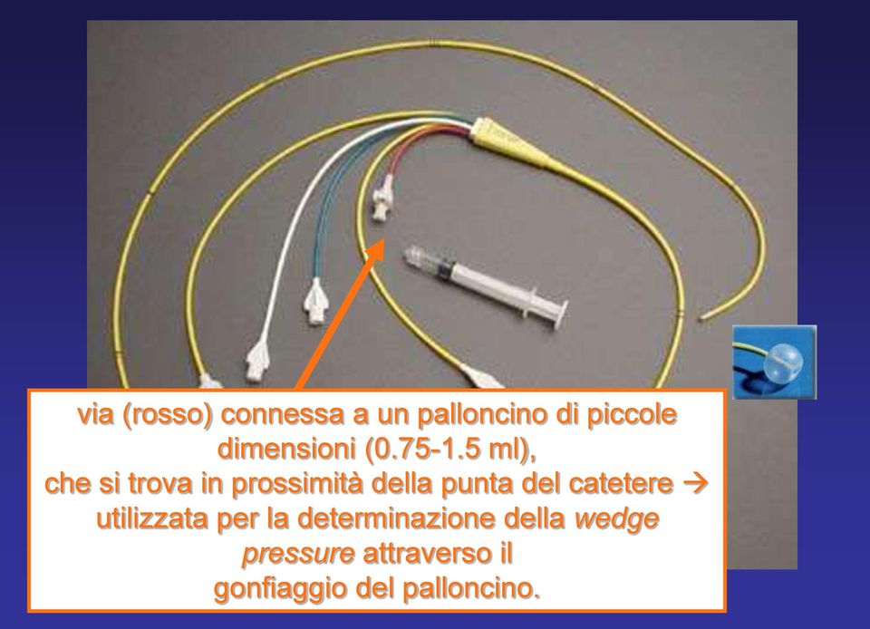 5 ml), che si trova in prossimità della punta del