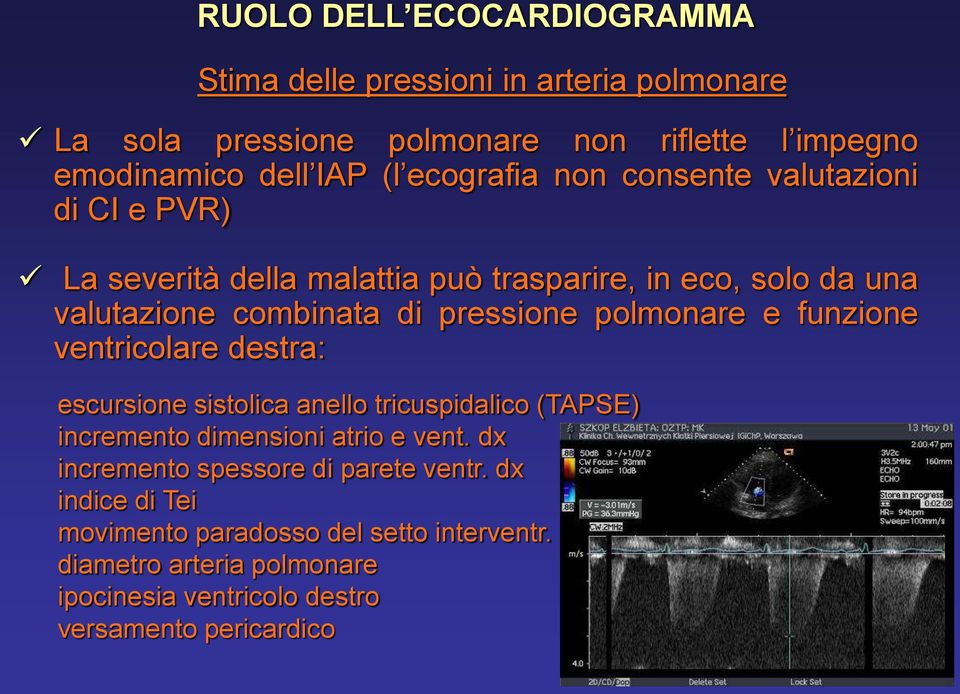 polmonare e funzione ventricolare destra: escursione sistolica anello tricuspidalico (TAPSE) incremento dimensioni atrio e vent.