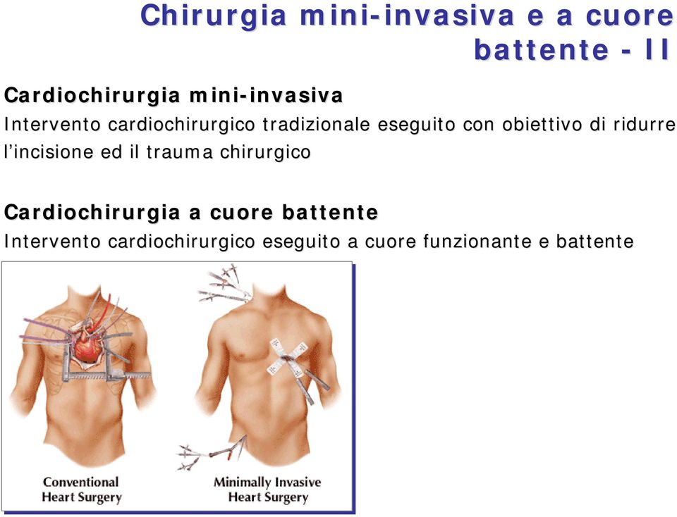 obiettivo di ridurre l incisione ed il trauma chirurgico Cardiochirurgia a