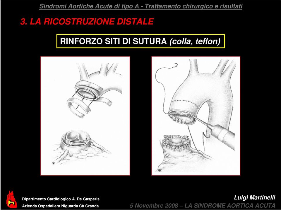 De Gasperis Azienda Ospedaliera Niguarda Cà Granda