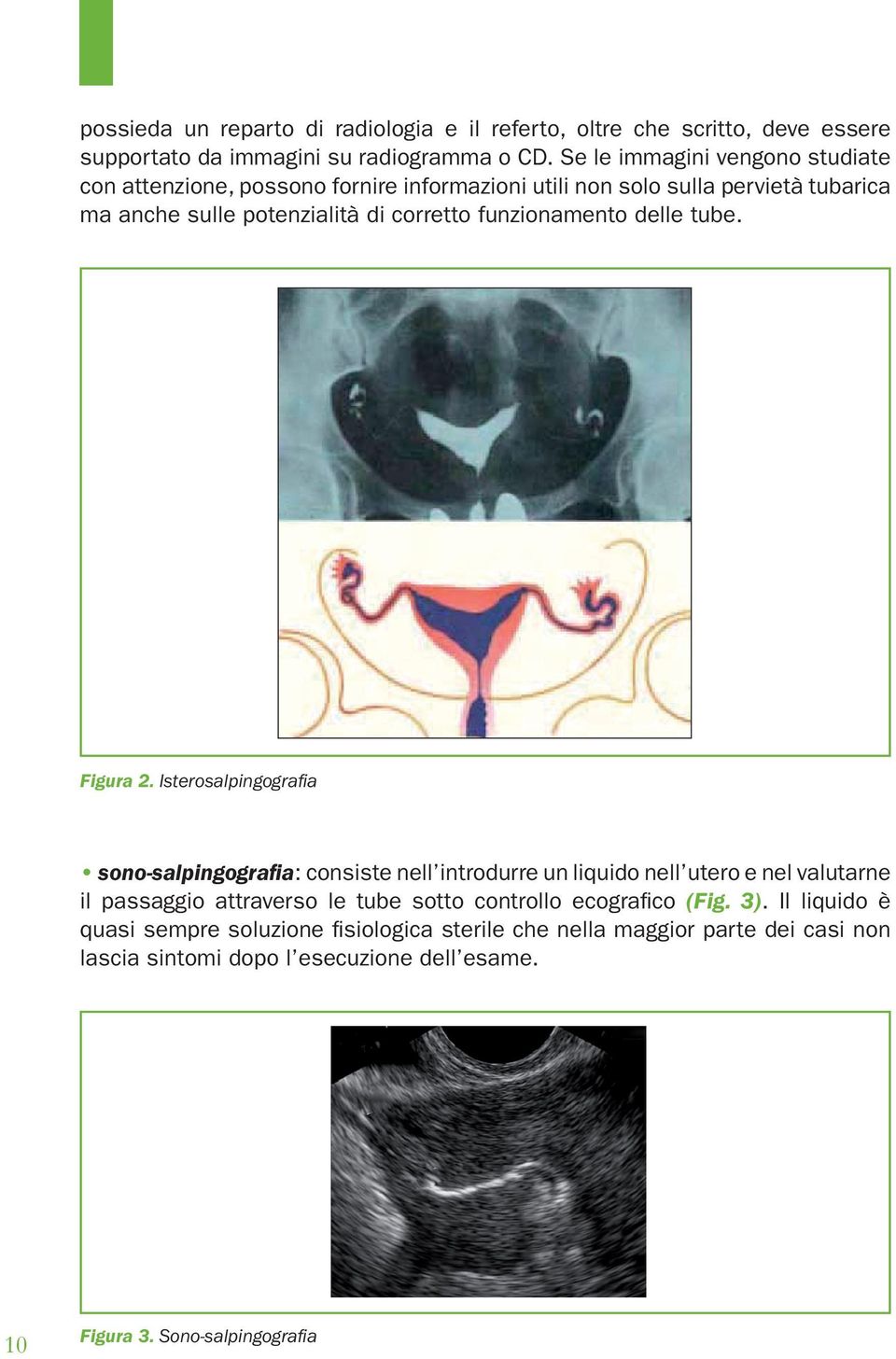 funzionamento delle tube. Figura 2.