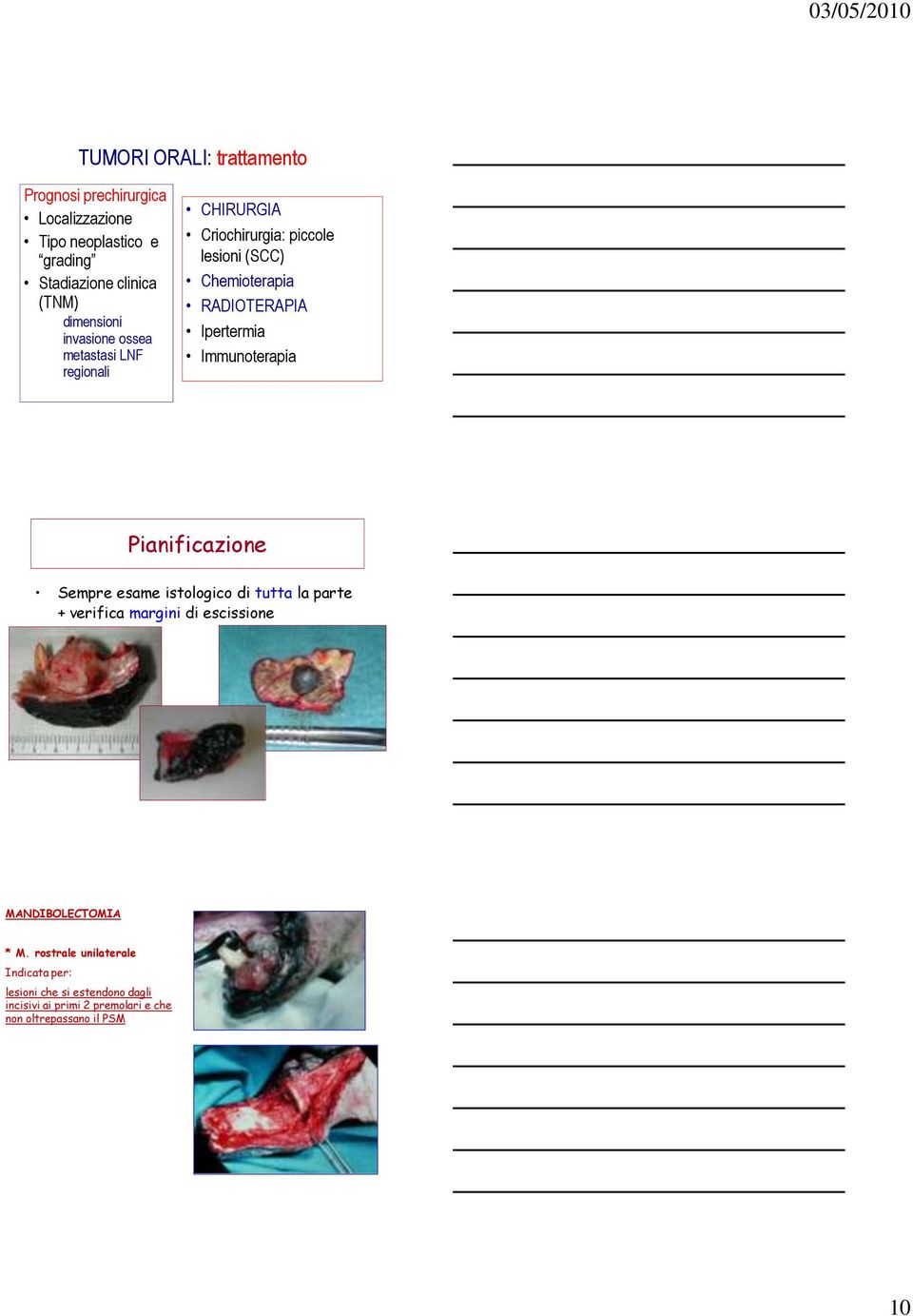 Ipertermia Immunoterapia Pianificazione Sempre esame istologico di tutta la parte + verifica margini di escissione