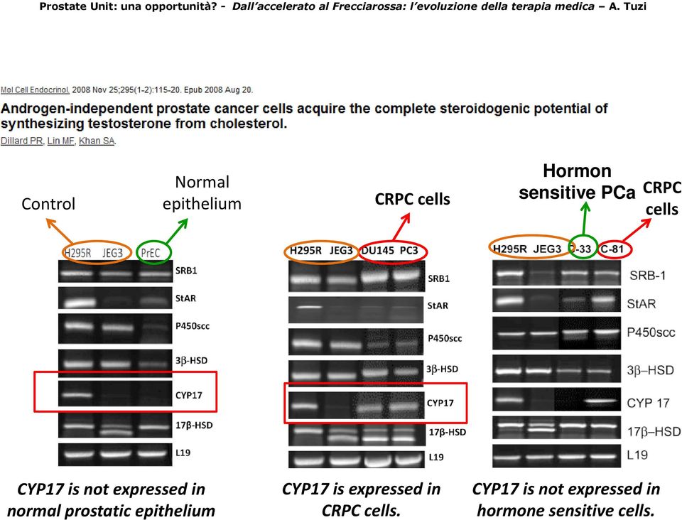 normal prostatic epithelium CYP17 is expressed in
