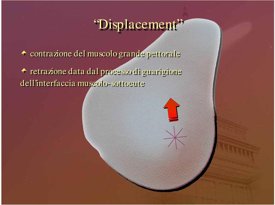 retrazione data dal processo di