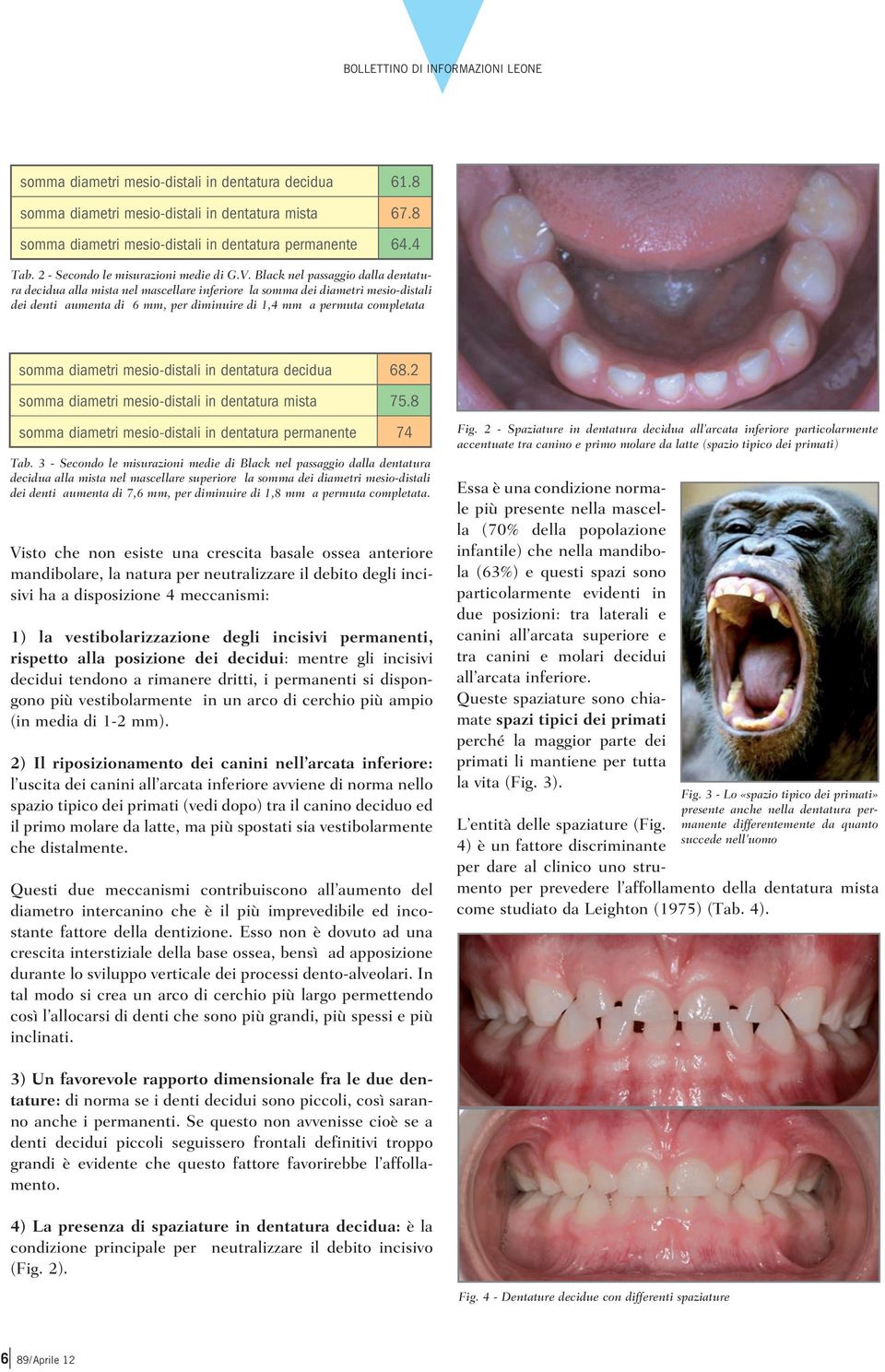 Black nel passaggio dalla dentatura decidua alla mista nel mascellare inferiore la somma dei diametri mesio-distali dei denti aumenta di 6 mm, per diminuire di 1,4 mm a permuta completata somma