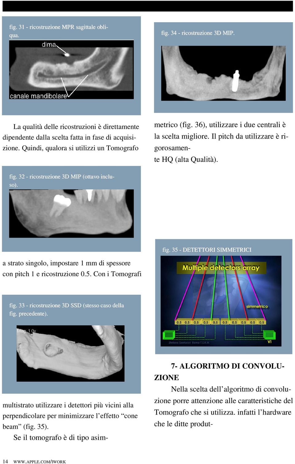 32 - ricostruzione 3D MIP (ottavo incluso). fig. 35 - DETETTORI SIMMETRICI a strato singolo, impostare 1 mm di spessore con pitch 1 e ricostruzione 0.5. Con i Tomografi fig.