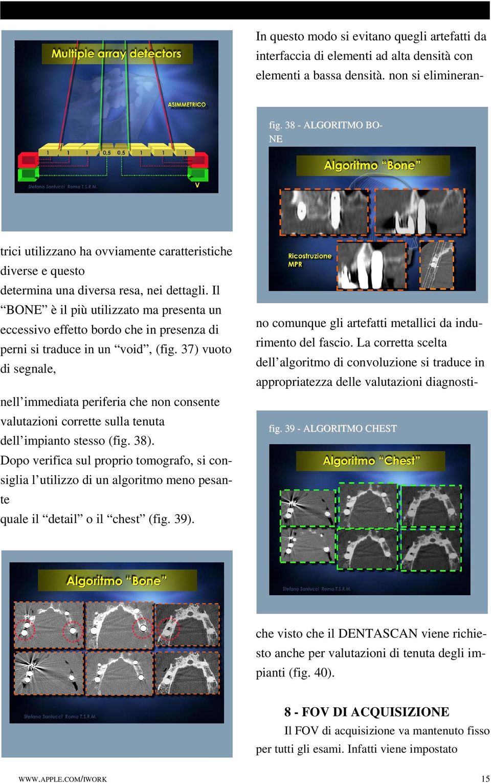 Il BONE è il più utilizzato ma presenta un eccessivo effetto bordo che in presenza di perni si traduce in un void, (fig.