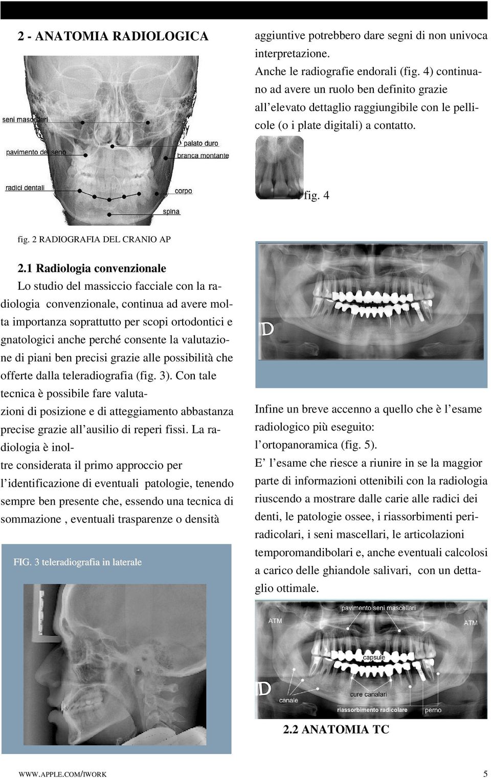 1 Radiologia convenzionale Lo studio del massiccio facciale con la radiologia convenzionale, continua ad avere molta importanza soprattutto per scopi ortodontici e gnatologici anche perché consente