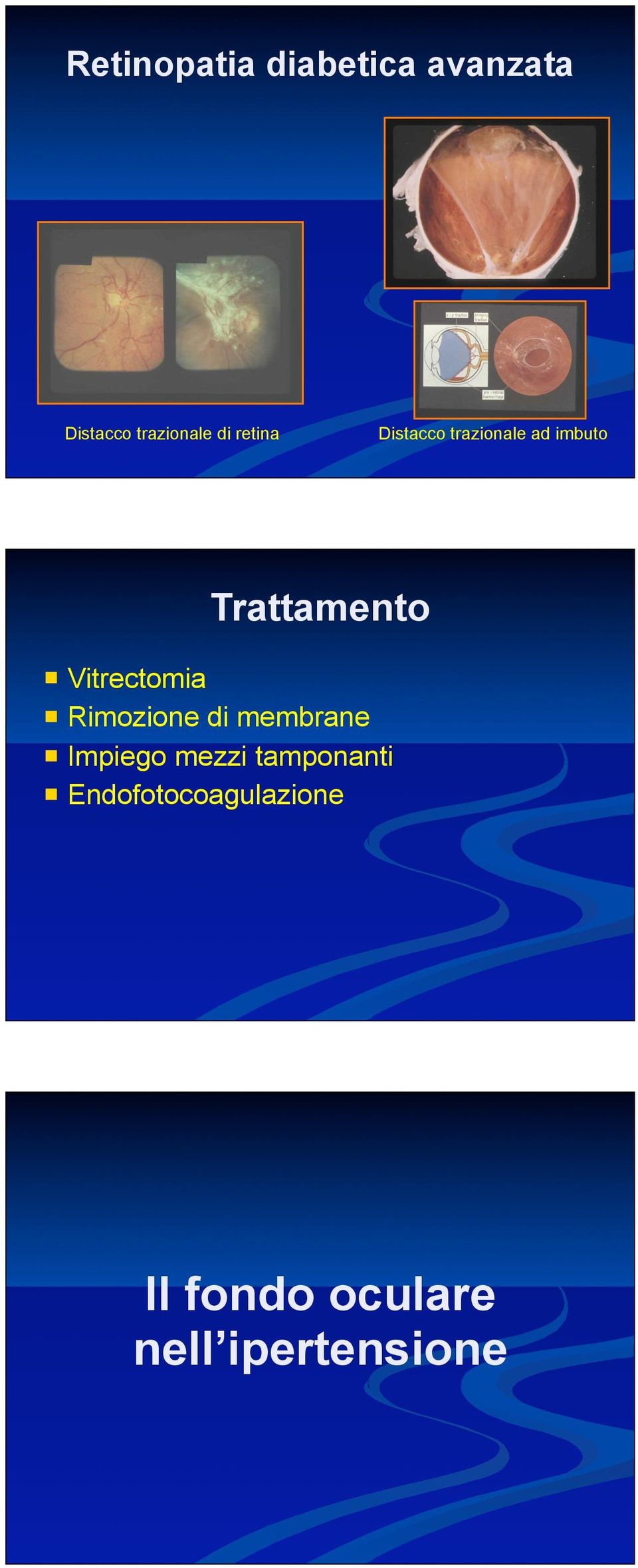 Trattamento Rimozione di membrane Impiego mezzi