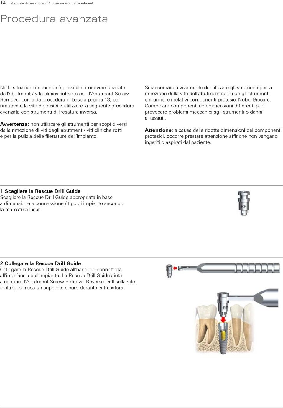 Avvertenza: non utilizzare gli strumenti per scopi diversi dalla rimozione di viti degli abutment / viti cliniche rotti e per la pulizia delle filettature dell'impianto.