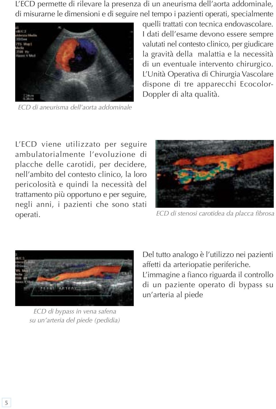 L Unità Operativa di Chirurgia Vascolare dispone di tre apparecchi Ecocolor- Doppler di alta qualità.