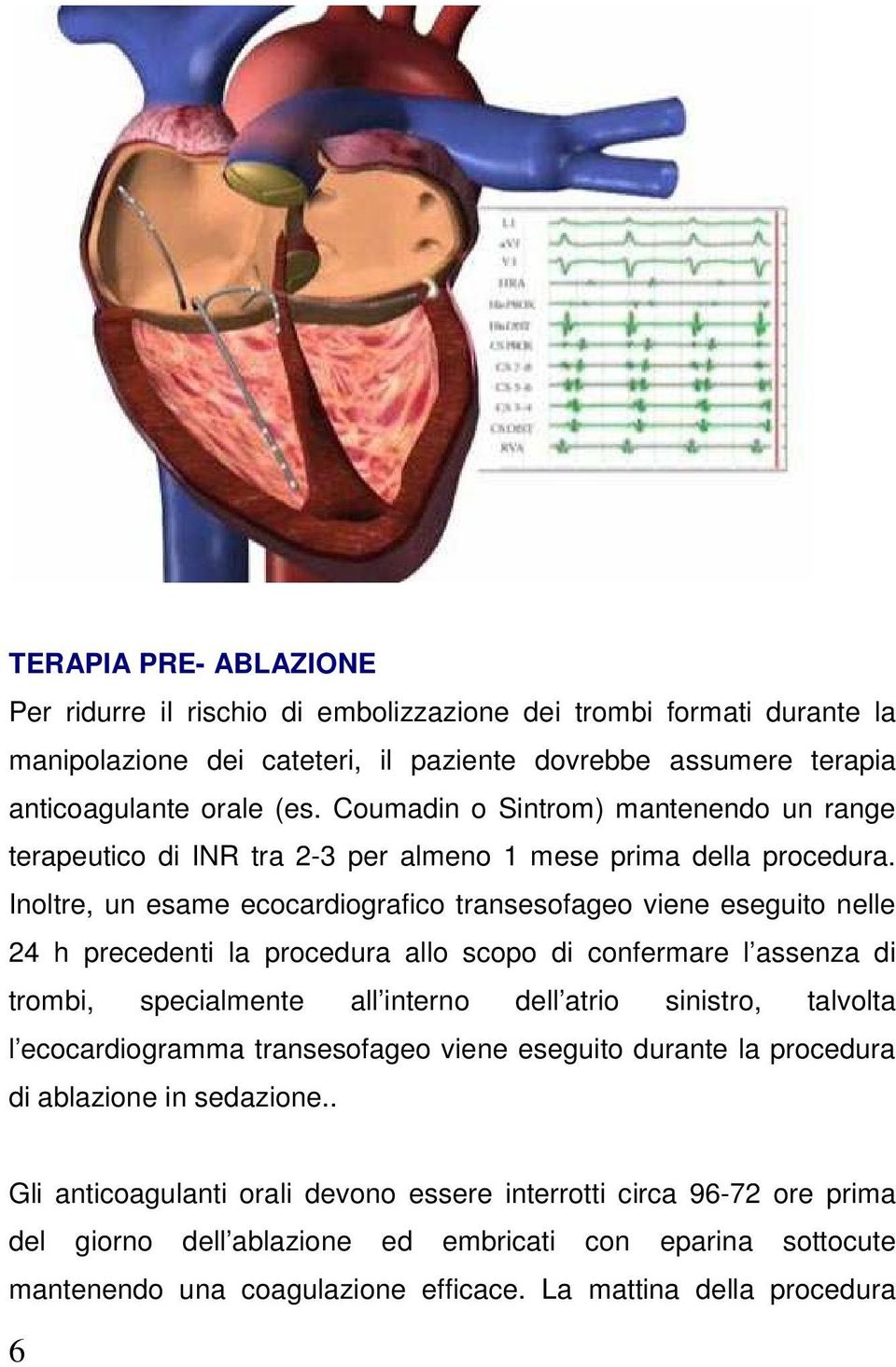 Inoltre, un esame ecocardiografico transesofageo viene eseguito nelle 24 h precedenti la procedura allo scopo di confermare l assenza di trombi, specialmente all interno dell atrio sinistro,