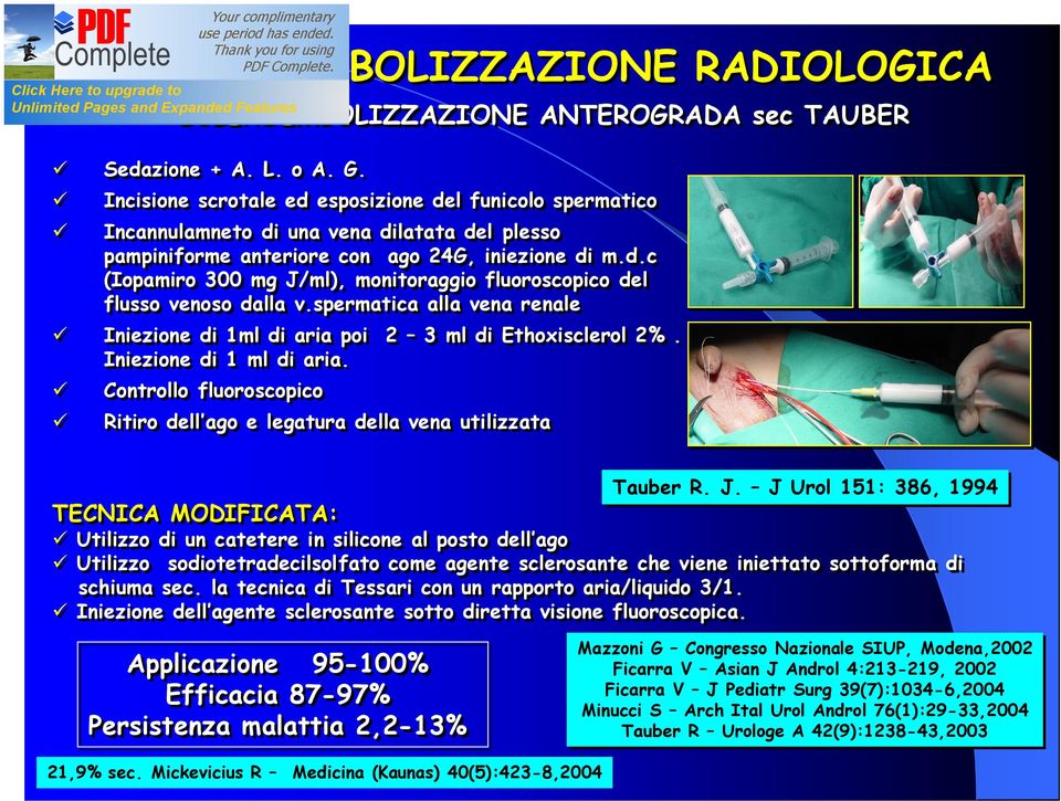 spermatica alla vena renale Iniezione di 1ml di aria poi 2 3 ml di Ethoxisclerol 2%. Iniezione di 1 ml di aria.