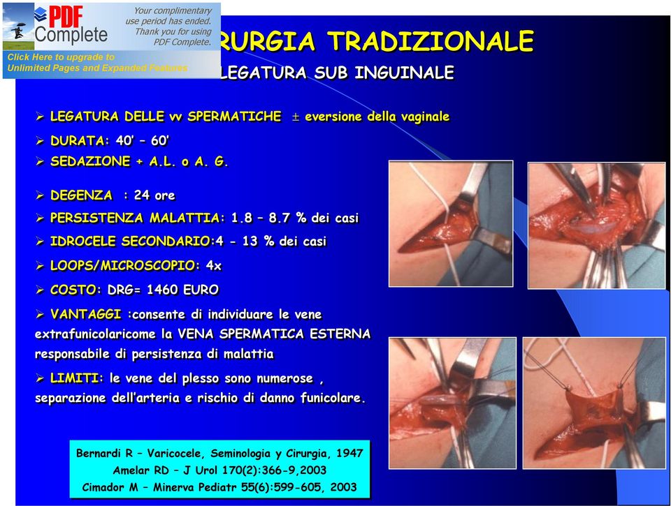 7 % dei casi IDROCELE SECONDARIO:4-13 % dei casi LOOPS/MICROSCOPIO: 4x COSTO: DRG= 1460 EURO VANTAGGI :consente di individuare le vene extrafunicolaricome la