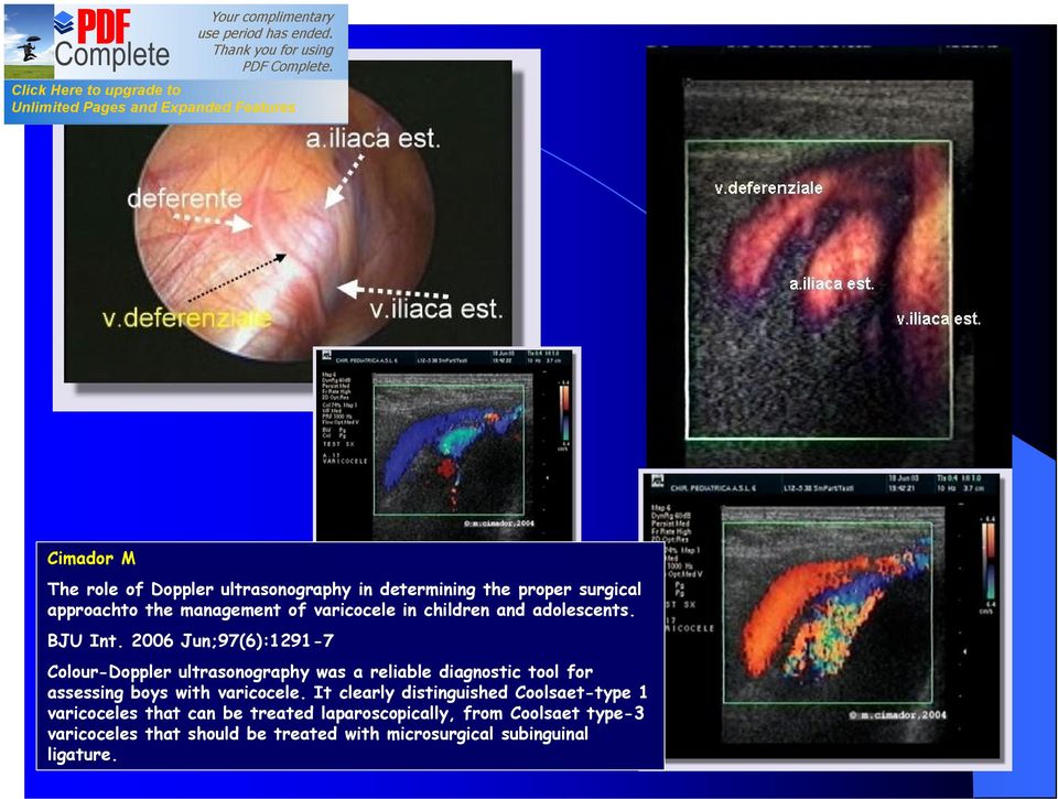 2006 Jun;97(6):1291-7 Colour-Doppler ultrasonography was a reliable diagnostic tool for assessing boys with